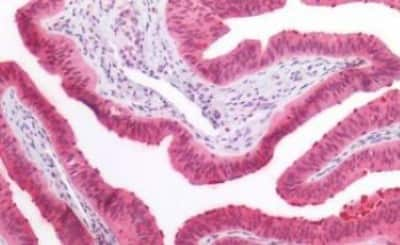 Immunohistochemistry-Paraffin: CCDC6 Antibody [NBP3-14556] - Human Fallopian Tube: Formalin-Fixed, Paraffin-Embedded (FFPE)